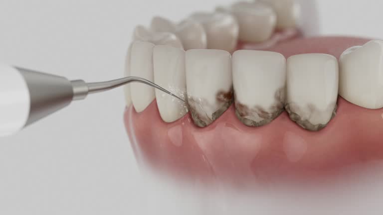 Trusted Tooth Extraction service in Birmingham, MI - Dentist Open Now
